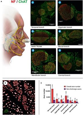 Axonal mapping of the motor cranial nerves